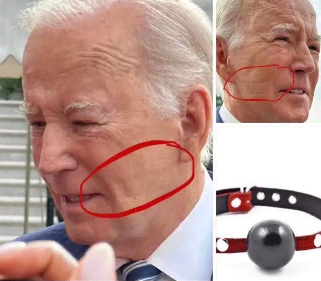 biden-strap-marks-on-face-ball-1024x899.jpg