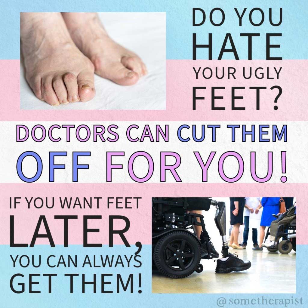 Read more about the article do you hate your ugly feet?